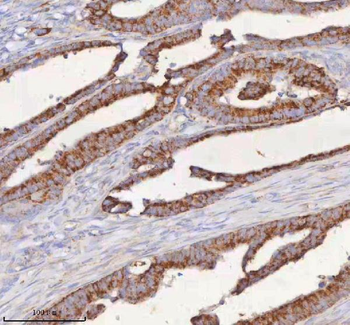 Anti-SLC6A20 Antibody