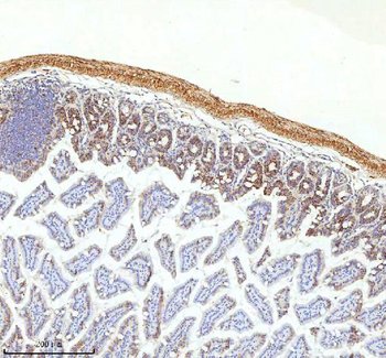 Anti-SLC6A20 Antibody