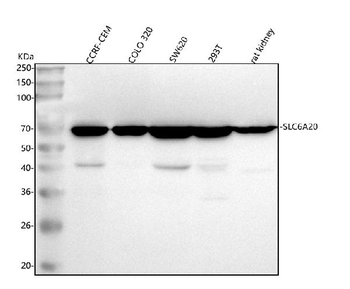 Anti-SLC6A20 Antibody