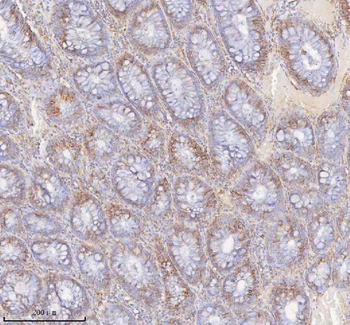 Anti-SLC6A20 Antibody