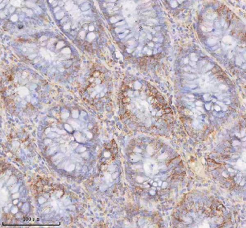 Anti-SLC6A20 Antibody