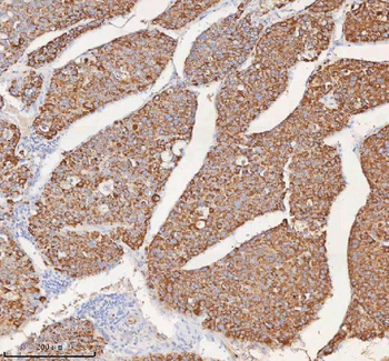 Anti-SLC6A20 Antibody