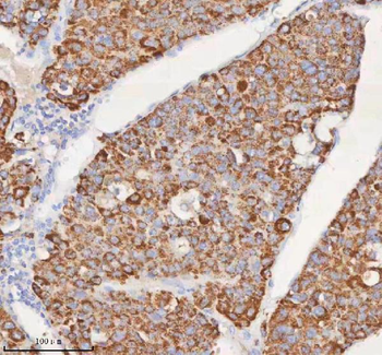 Anti-SLC6A20 Antibody