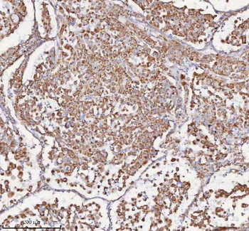 Anti-SLC6A20 Antibody