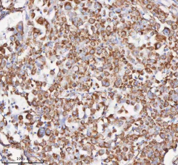 Anti-SLC6A20 Antibody