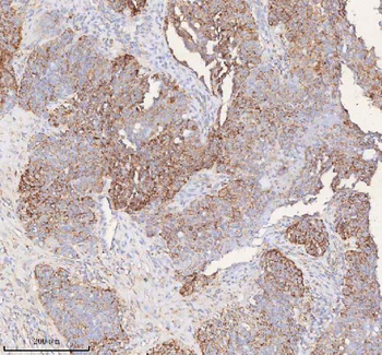 Anti-SLC6A20 Antibody