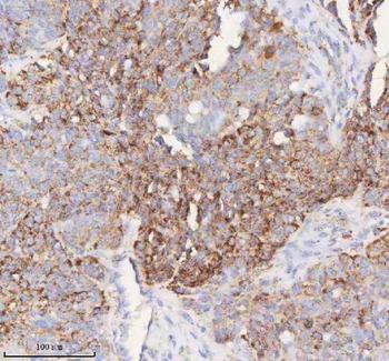 Anti-SLC6A20 Antibody