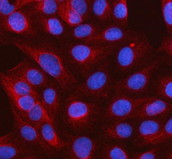 Anti-SLC37A3 Antibody