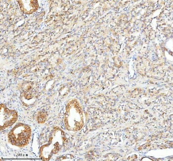 Anti-SLC25A25 Antibody