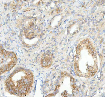 Anti-SLC25A25 Antibody