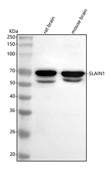 Anti-SLAIN1 Antibody