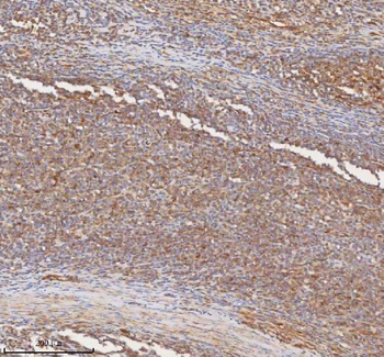 Anti-SHKBP1 Antibody