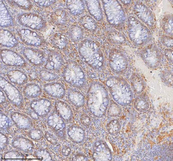 Anti-SHKBP1 Antibody