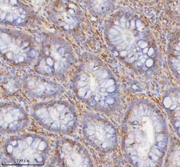 Anti-SHKBP1 Antibody