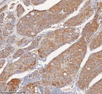 Anti-SHKBP1 Antibody