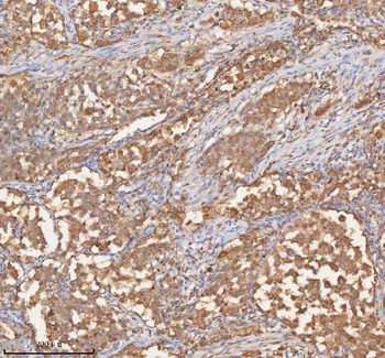 Anti-SHKBP1 Antibody