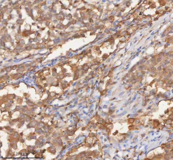 Anti-SHKBP1 Antibody