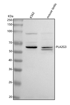 Anti-PLA2G3 Antibody