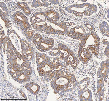 Anti-PCCA Antibody