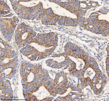 Anti-PCCA Antibody