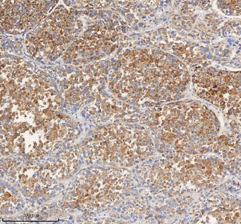 Anti-PCCA Antibody