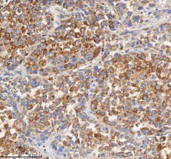 Anti-PCCA Antibody