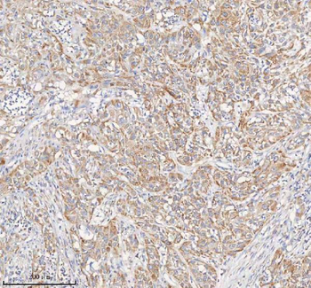 Anti-PCCA Antibody