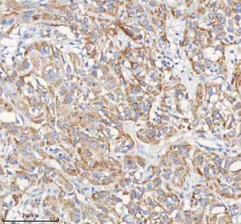Anti-PCCA Antibody