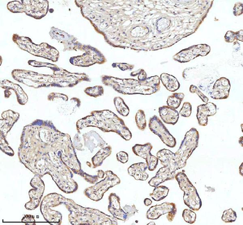 Anti-MIPEP Antibody