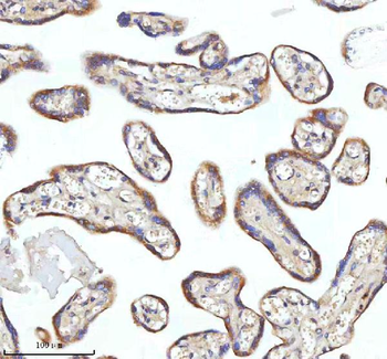 Anti-MIPEP Antibody