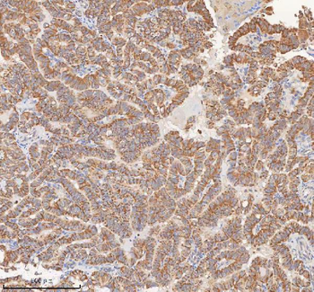 Anti-MIPEP Antibody