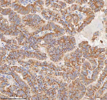 Anti-MIPEP Antibody