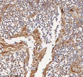Anti-MIPEP Antibody