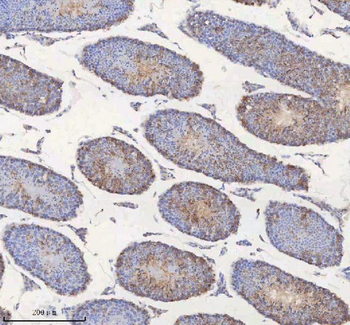 Anti-MIPEP Antibody