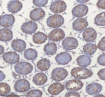 Anti-MIPEP Antibody