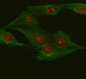 Anti-METTL18 Antibody