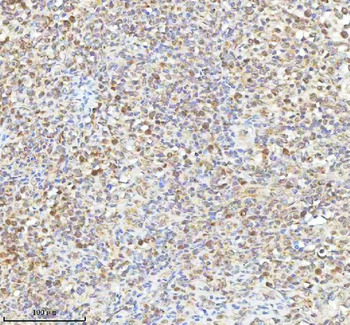 Anti-METTL18 Antibody