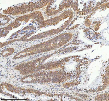 Anti-METTL18 Antibody