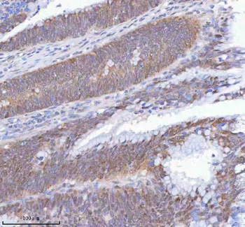 Anti-METTL18 Antibody