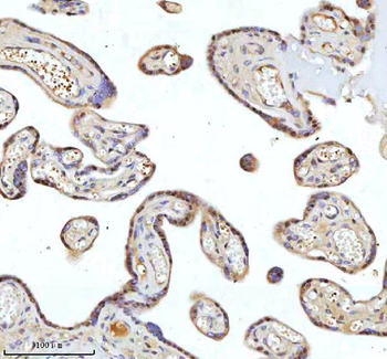 Anti-METTL18 Antibody