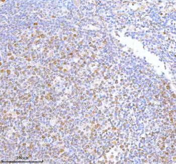 Anti-METTL18 Antibody