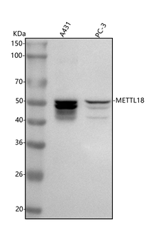 Anti-METTL18 Antibody