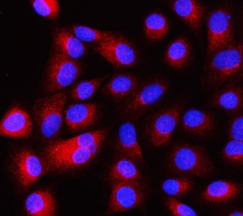 Anti-Intersectin 1/ITSN1 Antibody