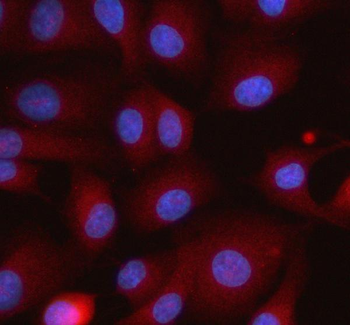 Anti-ITPRIPL1 Antibody