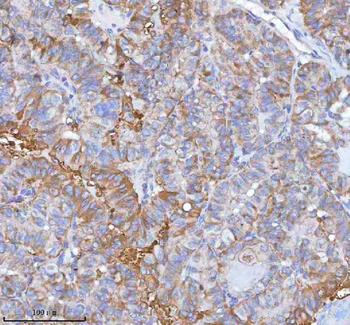 Anti-hIST1/IST1 Antibody
