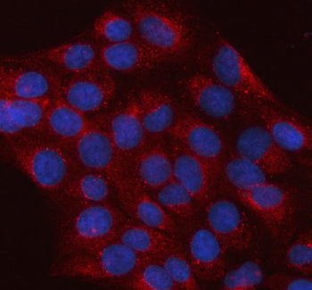 Anti-hIST1/IST1 Antibody