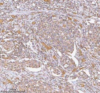 Anti-hIST1/IST1 Antibody