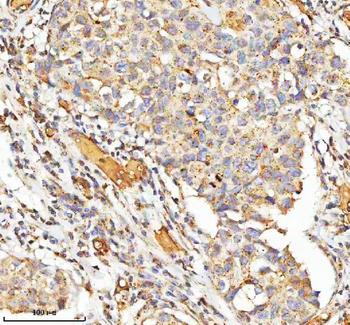 Anti-hIST1/IST1 Antibody