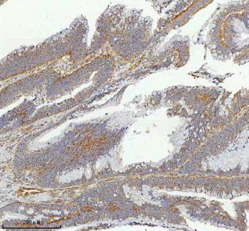 Anti-hIST1/IST1 Antibody