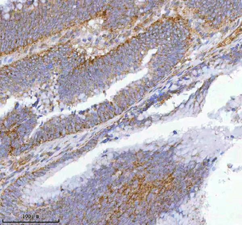Anti-hIST1/IST1 Antibody